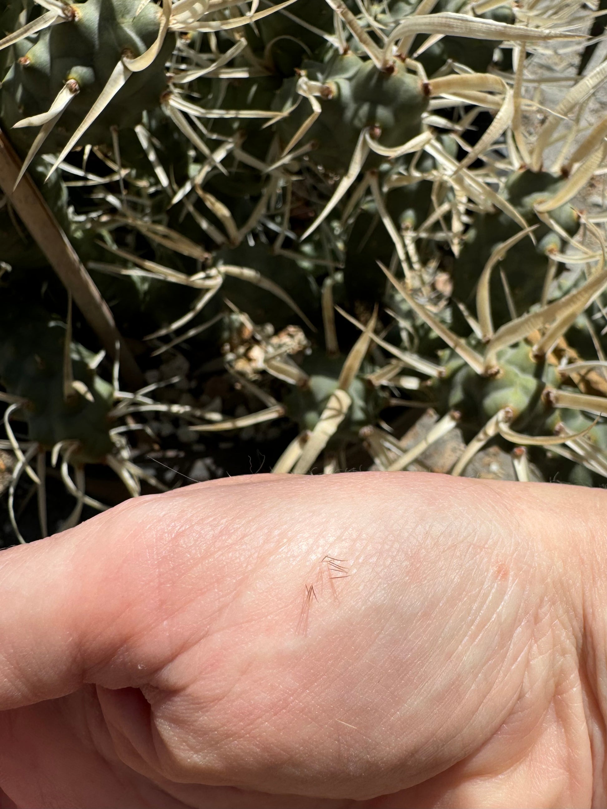 The tephrocactus in the background, with a hand in the foreground. There are bunches of small thin spines in the palm.